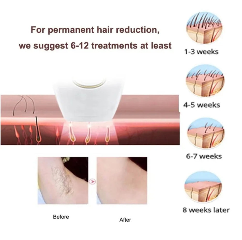 IPL Permanent Laser Hair Removal Device