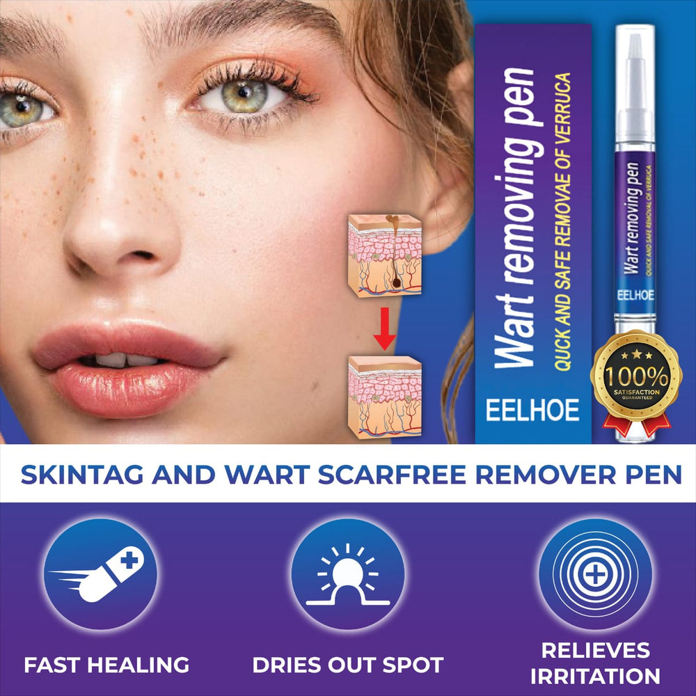 Skin Tag, Mole & Wart Remover Pen