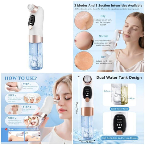 Hydra Facial Blackhead & Whitehead Remover