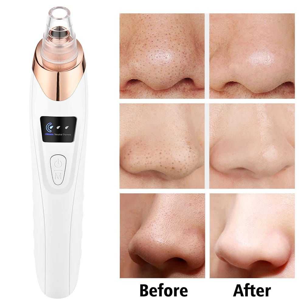 5in1 Blackhead Remover Machine Rechargeable